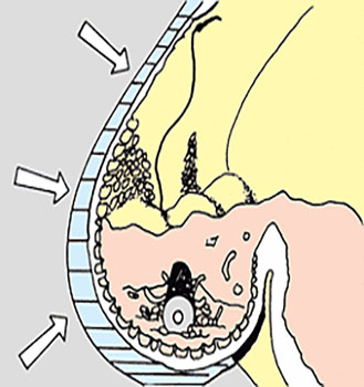 High Strength Livestock Stomach Magnet